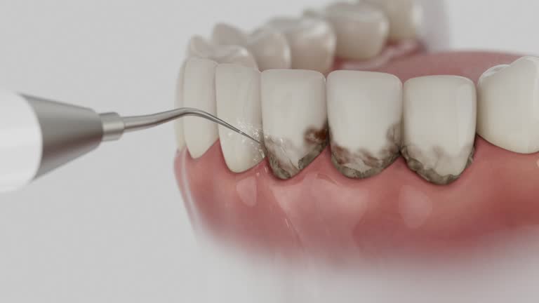 Trusted Teeth Cleaning And Checkup service in Hermann, MO - Dentist Open Now
